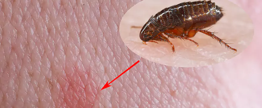 Flea Control for Humans Katy, TX